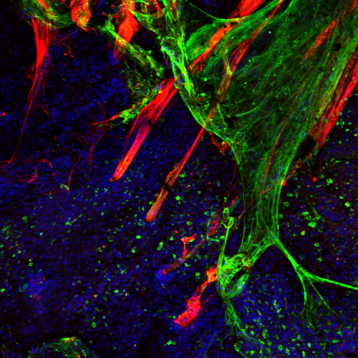 Mucus and CF image