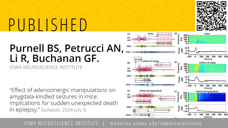 Buchanan Lab publishes in July 2024 Epilepsia